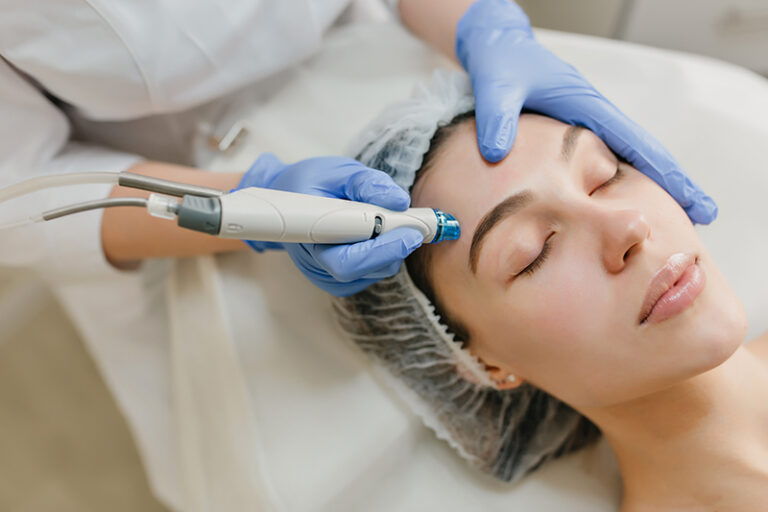 microneedling 768x512
